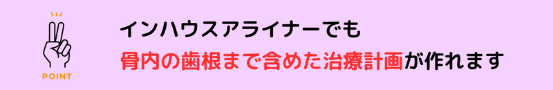 インハウスアライナーでも骨の歯根まで含めた治療計画が作れます