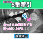 8番（親知らず）の牽引（その１）