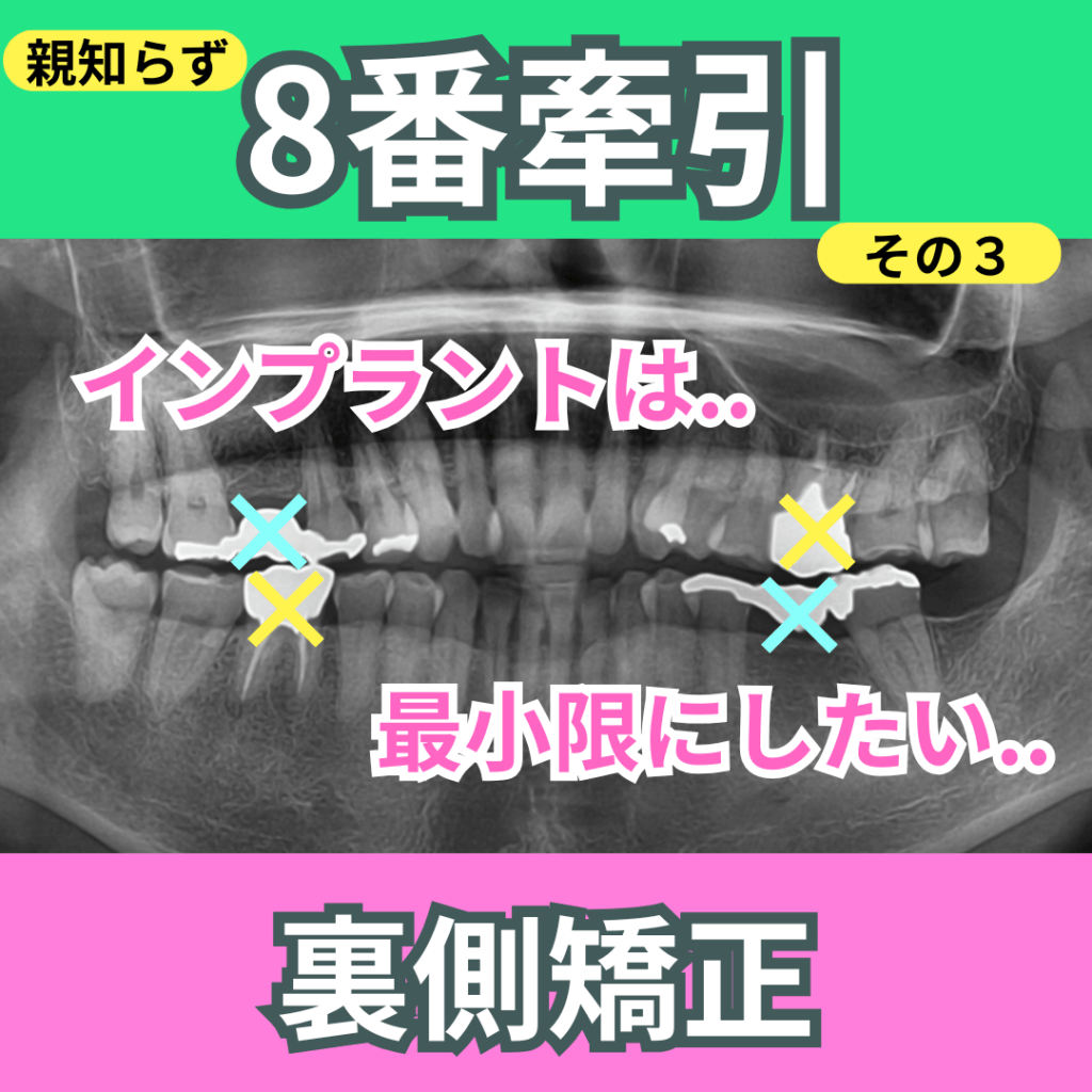 8番の牽引（インプラントも併用）