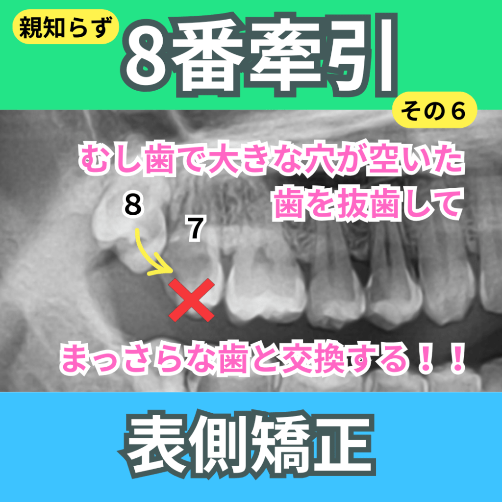 8番の牽引（その６）