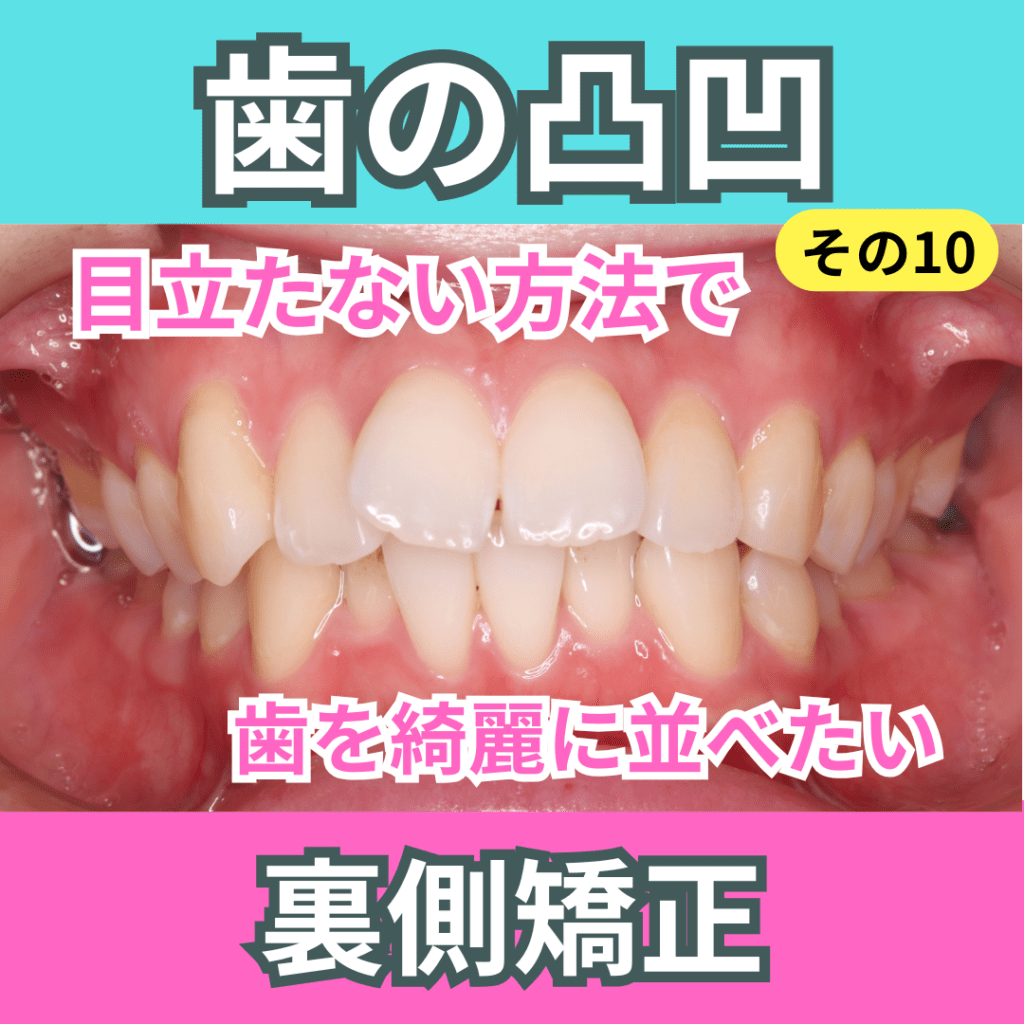 叢生10（ハーフリンガル）
