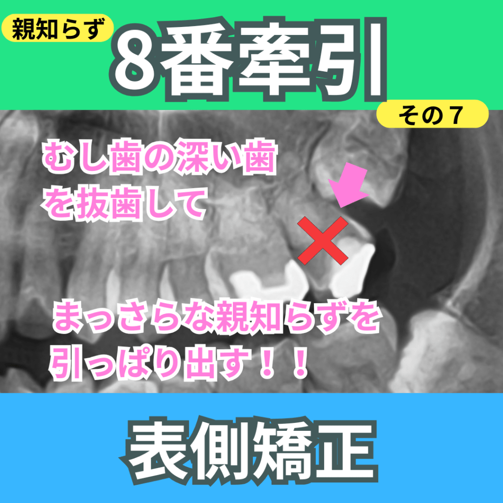 8番の牽引（その7）