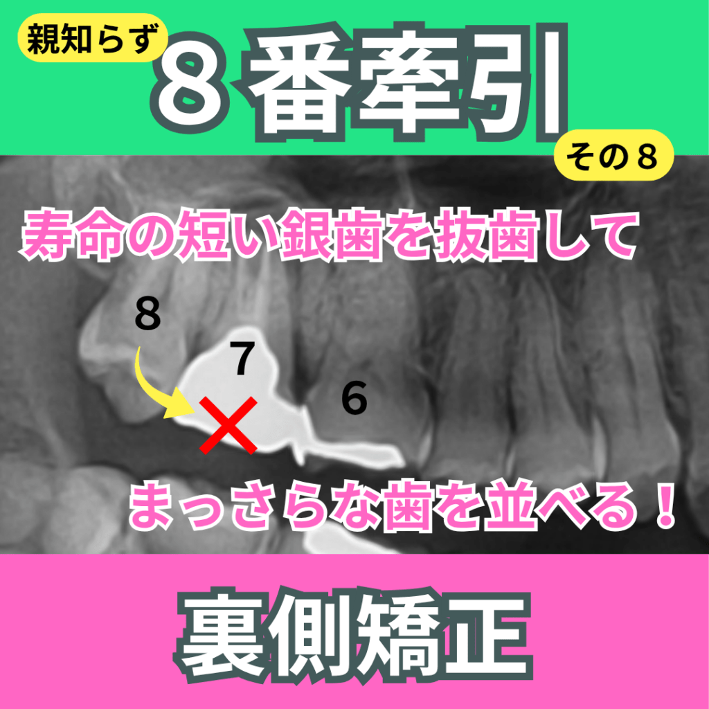 8番の牽引（その8）